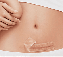 Load image into Gallery viewer, Gel Scar Therapy Patch