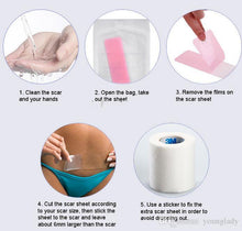 Load image into Gallery viewer, Gel Scar Therapy Patch