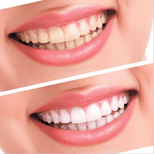 Load image into Gallery viewer, [2-Pack] White Bright - Now Teeth Whitening Changes Forever
